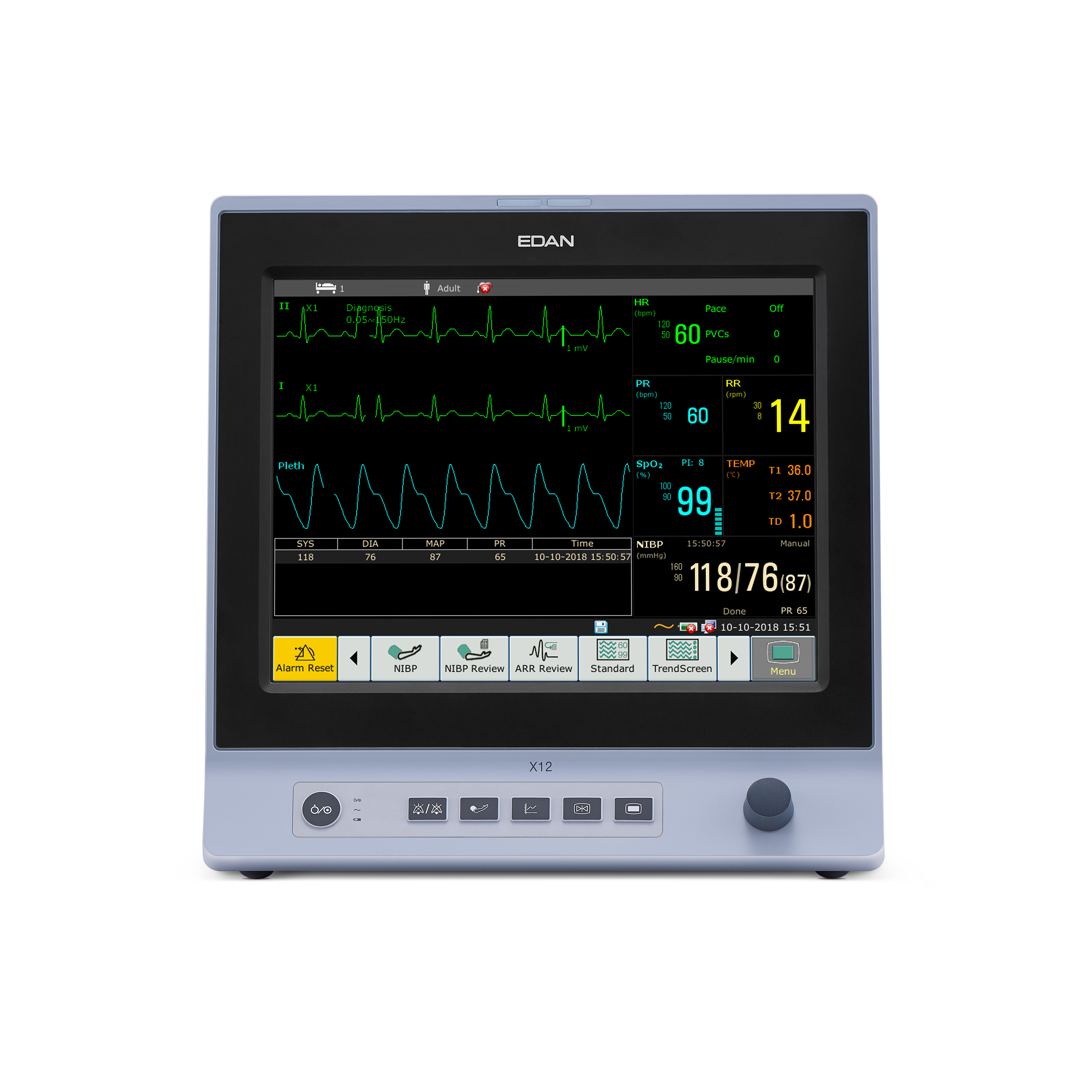 Monitor EDAN X12